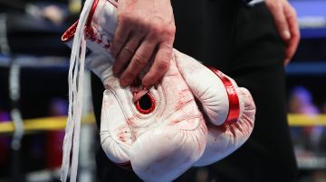 Imagen de referencia de unos guantes de boxeo.