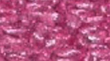 Paciente en Massachusetts es el primer caso de viruela del simio en EE.UU. durante 2022