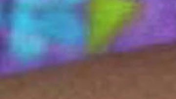 UNDATED ? JUNE 5: In this Centers for Disease Control and Prevention handout graphic, symptoms of one of the first known cases of the monkeypox virus are shown on a patient?s hand June 5, 2003. The CDC said the viral disease monkeypox, thought to be spread by prairie dogs, has been detected in the Americas for the first time with about 20 cases reported in Wisconsin, Illinois, and Indiana. (Photo Courtesy of CDC/Getty Images)