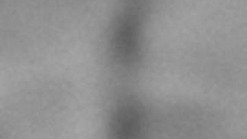 Viruela del mono CDC Contagios