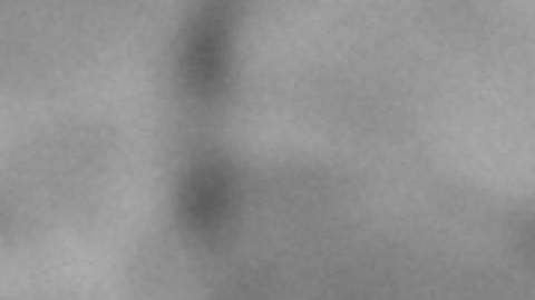 Viruela del mono CDC Contagios