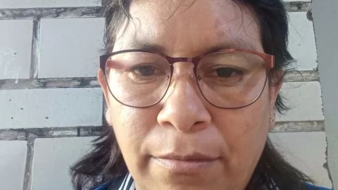 Marisol García Alcántara tiene, encima de su ceja izquierda, la cicatriz que le dejó la bala.
