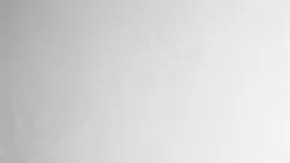 Se han reportado casos de viruela del mono por años en África.