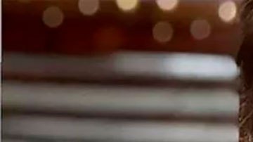 Síndrome de Ramsay Hunt: cómo es vivir con la condición que sufre Justin Bieber