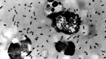 Dientes antiguos revelan por fin dónde se originó la peste negra, la más mortífera de la historia