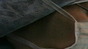 "Podría salvar muchas vidas": trasplantan con éxito un hígado que fue conservado con una nueva tecnología