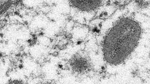 CR-Health-InlineHero-Questions-Answered-Monkey-Pox-0522