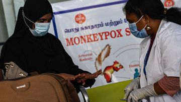 La OMS dice que viruela del mono es un "riesgo real" para la humanidad