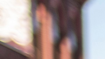 Texas Austin Vasectomía Ligadura de Trompas esterilización