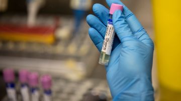 EE.UU. ampliará la vacunación contra la viruela del mono en los próximos días. aumento de casos