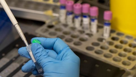 OMS investiga reportes del virus de la viruela del mono presente en el semen