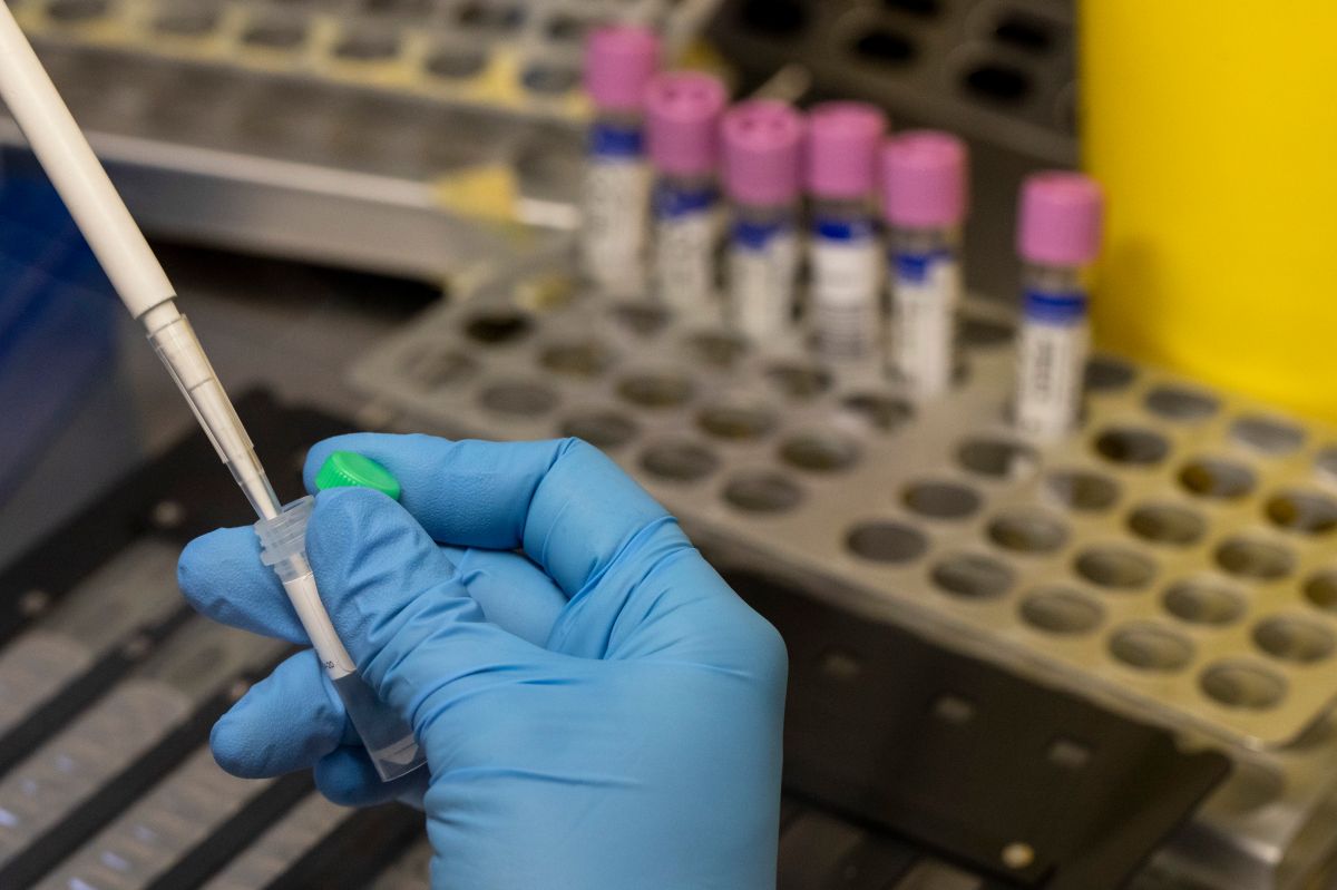 OMS investiga reportes del virus de la viruela del mono presente en el semen
