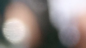 El dominicano estará varias semanas fuera de acción.