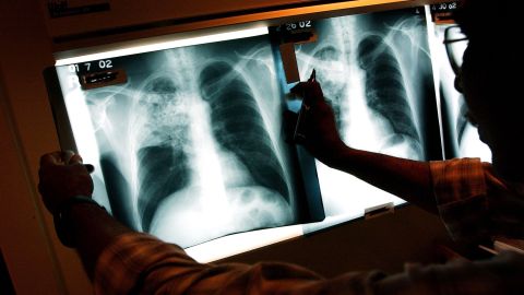 Los hispanos con más de 20 años en EE.UU. son más asiduos a acudir al médico.