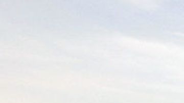 Queman a mujer en el rostro en parque de Philadelphia