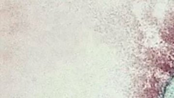 La preocupación por el primer brote en Ghana del mortal virus de Marburgo, de la misma familia que el ébola