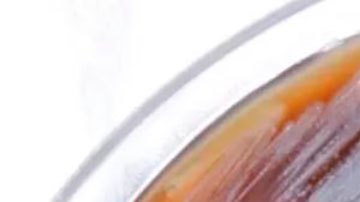 La peligrosa bacteria encontrada en EE.UU. que preocupa a las autoridades de salud del país