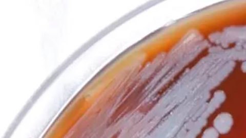 La peligrosa bacteria encontrada en EE.UU. que preocupa a las autoridades de salud del país