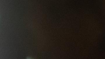 Comité de la OMS se reunirá para decidir si declara emergencia internacional por viruela del mono