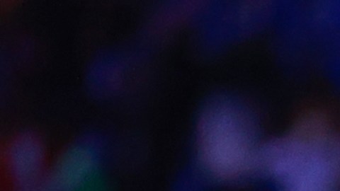 El venezolano Fernando Aristeguieta sufrió una grave lesión que lo mantendrá alejado de las canchas el resto de la temporada.
