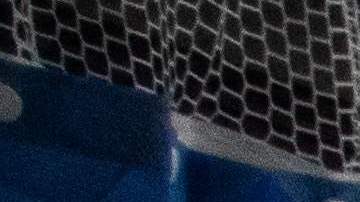 Health care workers attend to a patient with Covid-19 as they prepare to turn the 45 year old unvaccinated patient from his stomach onto his back at the Cardiovascular Intensive Care Unit at Providence Cedars-Sinai Tarzana Medical Center in Tarzana, California on September 2, 2021. - According to Dr. Yadegar at the hospital, the number of covid patients are significantly less than they were in winter, but from a psychological standpoint it's much more difficult because most of the patients in the ICU on respirators are unvaccinated, younger and healthier 30 and 40 year olds without comorbidities. Vaccinated patients at the hospital are typically older, but the Covid-19 effects are much milder compared to the unvaccinated patients that have more severe symptoms. (Photo by Apu GOMES / AFP) (Photo by APU GOMES/AFP via Getty Images)