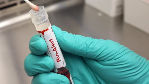 Nueva York declara que la viruela del mono es una "amenaza inminente para la salud pública"