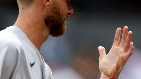 El lanzador estará fuera de tiempo indefinido.