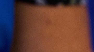 El 98% de los casos que han sido detectados es entre hombres que tienen relaciones sexuales con hombres.