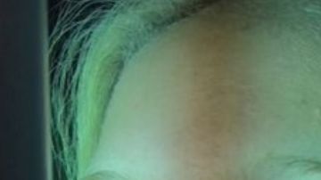 En su cuenta de TikTok ha compartido los detalles de su recuperación y evolución.