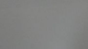 Le amputan ambas piernas y pierde el útero después de que le colocaron mal el DIU