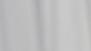 Reportan primera muerte por viruela del mono en América