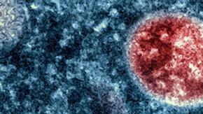 India confirma muerte de un hombre contagiado con viruela del mono