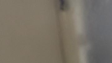 Perú registra su primer deceso por viruela del mono