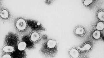 China advierte sobre nuevo virus que ha enfermado a 35 personas