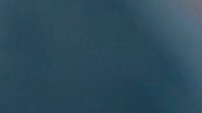 Cirujano plástico de Florida se hace viral por difundir los resultados de sus operaciones