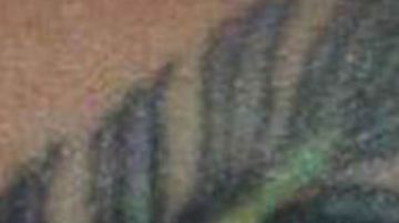 Hombre con viruela del mono narra la peor y aterradora experiencia con la enfermedad