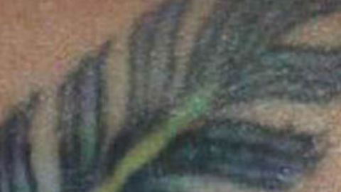 Hombre con viruela del mono narra la peor y aterradora experiencia con la enfermedad