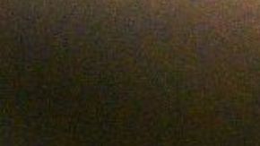 Niña de 2 años mató a una serpiente de una mordida, fue atacada primero por el reptil