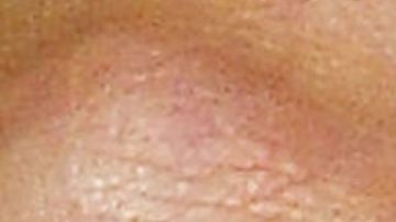 Perdió su anillo de bodas y un cazatesoros lo halló en el fondo del océano