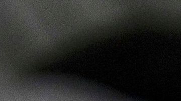 Texas confirma primera muerte en EE.UU. por viruela del mono en paciente gravemente inmunocomprometido