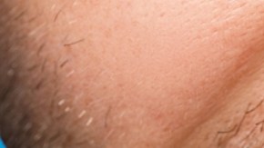 Las bacterias comunes en la boca y el riesgo cerebrovascular: qué dice un nuevo estudio