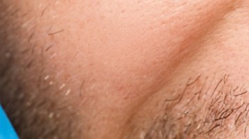 Las bacterias comunes en la boca y el riesgo cerebrovascular: qué dice un nuevo estudio