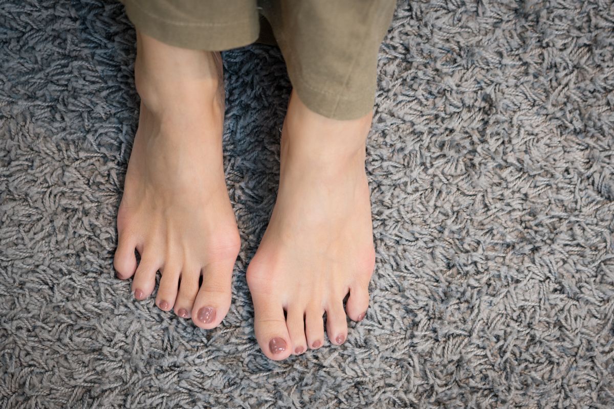 Para prevenir el dolor de juanetes es necesario escoger zapatos que se ajusten a la forma de tus pies y no los aprieten.