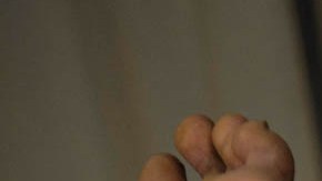 Avanza la viruela del mono