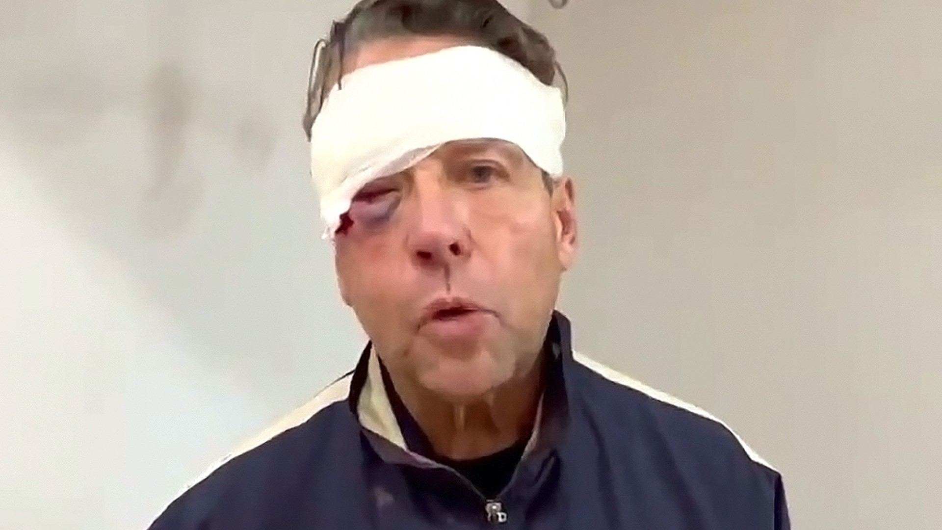 Actualmente, Alfredo Adame siente miedo después de fuerte golpiza y