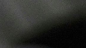 Viruela del mono: Autoridades de salud en Los Ángeles investigan muerte de una persona posiblemente causada por este virus