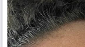 Miguel Mawad con el rostro como le habría quedado después de la supuesta pelea con Aleska