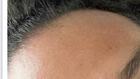 Miguel Mawad con el rostro como le habría quedado después de la supuesta pelea con Aleska