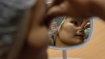 Mujer rompe en llanto tras operación en la que su rostro terminó desfigurado