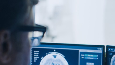 tratamiento antidepresivo tumor cerebral